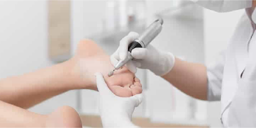 Medical Pedicure (Complex)