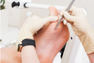 Calluses and Corns