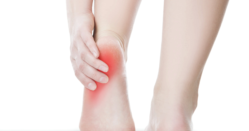 Plantar Fasciitis 1