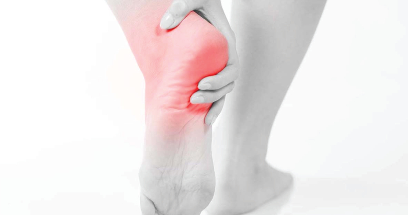 Plantar Fasciitis 3