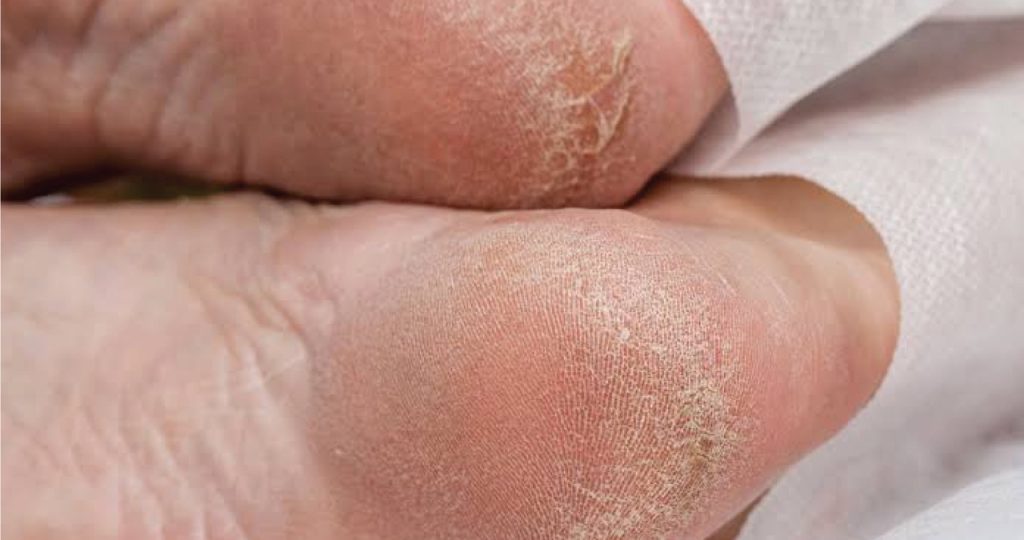 Common Foot Cases 1