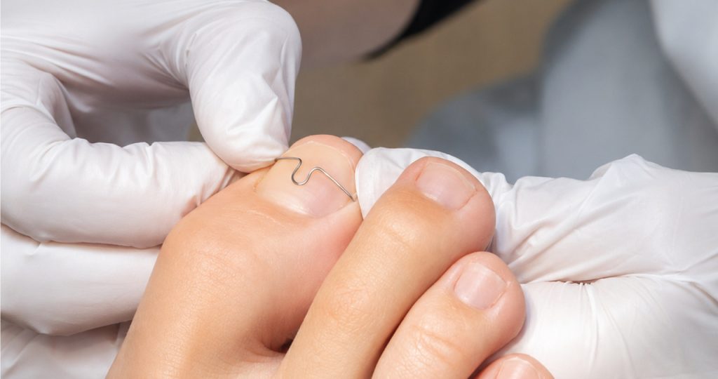 Common Foot Cases 2